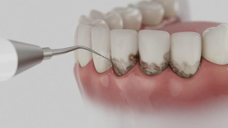 Reliable Dental contractor in Hallettsville, TX by Smile Center Dentistry